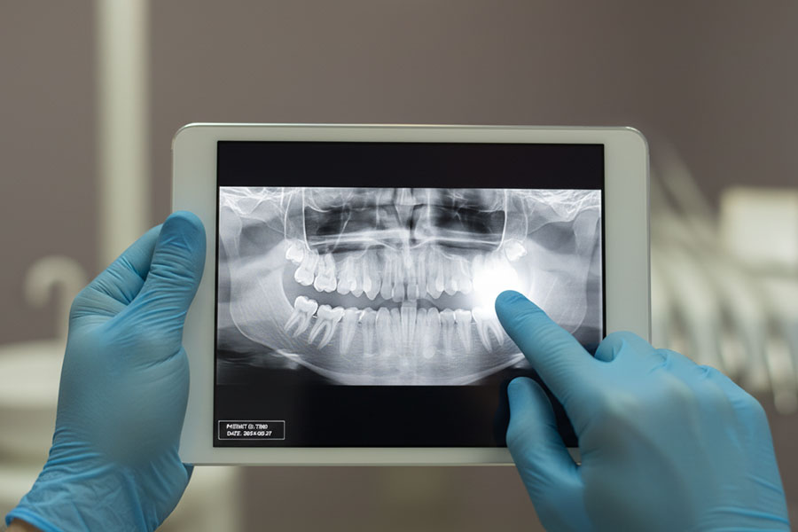 La Grange Dental Associates uses the newest dental technology in La Grange, IL to enhance the health and wellness of their patients. We offer quality dental service including dental implants in 60525 and teeth whitening in La Grange, IL. Dental Technology in La Grange, IL